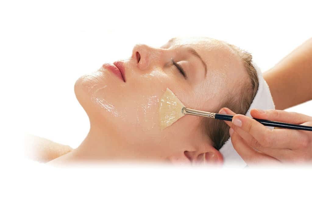 Kemisk peeling