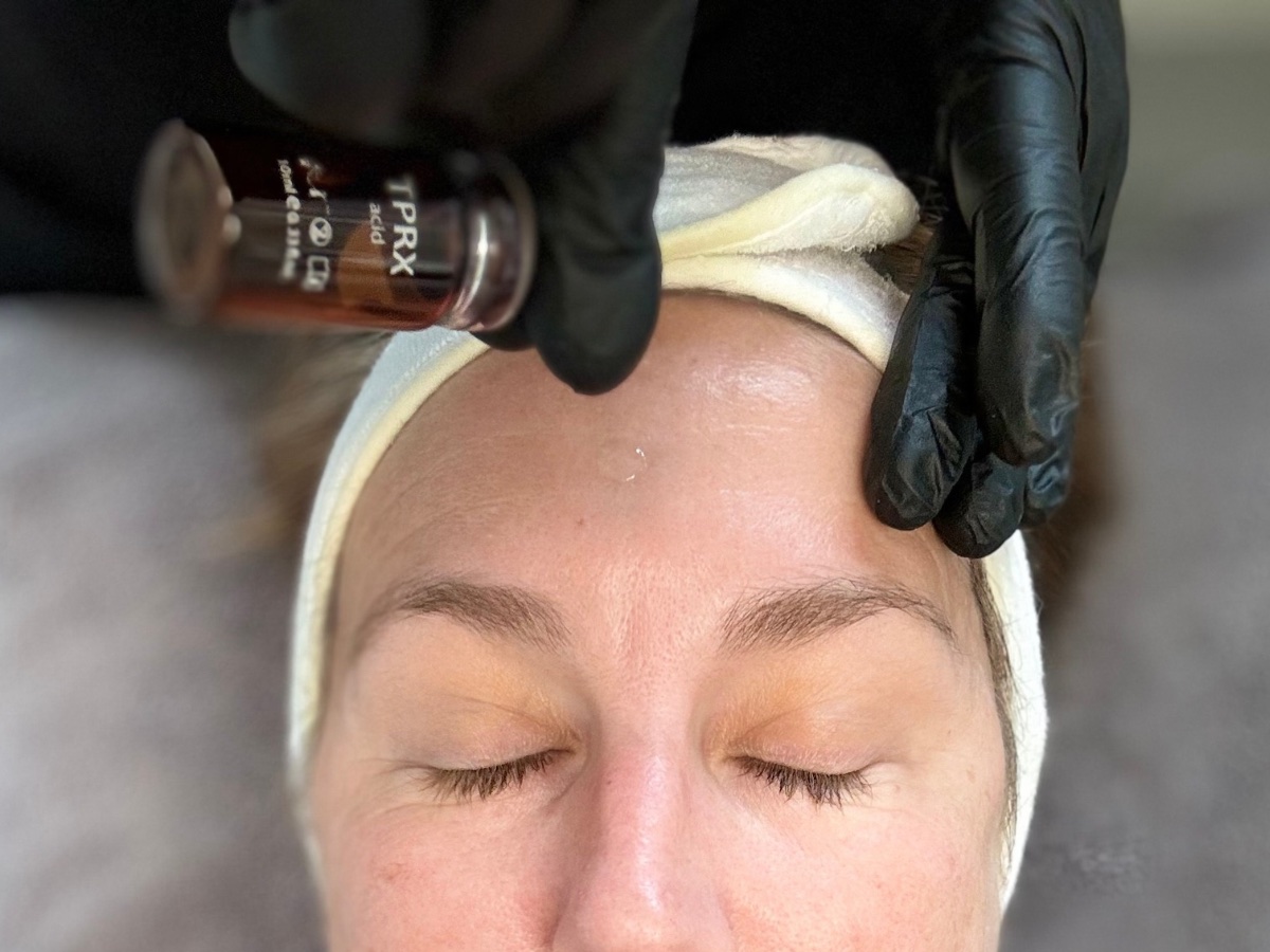 TPRX-Hudföryngrande peeling